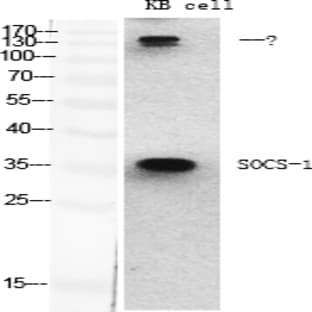 SOCS-1 Polyclonal Antibody avatar
