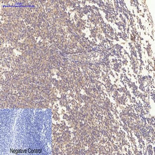 Bax Mouse Monoclonal Antibody(6F11) avatar