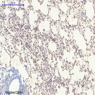 Bcl-2 Polyclonal Antibody avatar