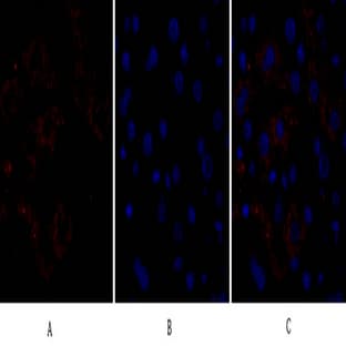 Caspase-8 Polyclonal Antibody avatar