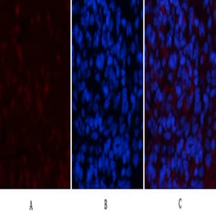 NBR1 Mouse Monoclonal Antibody(7C3) avatar