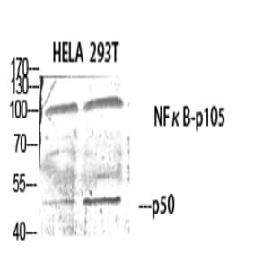 NF?B-p105/p50 Polyclonal Antibody avatar
