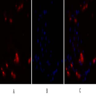 NF?B-p105/p50 Polyclonal Antibody avatar