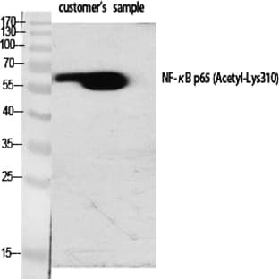NF?B-p65 (Acetyl Lys310) Polyclonal Antibody avatar
