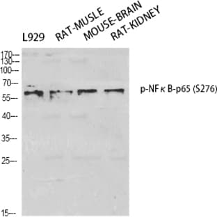 NF?B-p65 (phospho Ser276) Polyclonal Antibody avatar