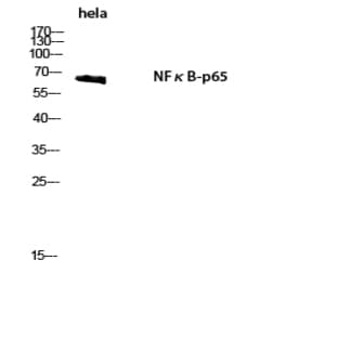 NF?B-p65 Polyclonal Antibody avatar