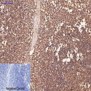 CD1 Monoclonal Antibody avatar