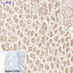 CD21 Monoclonal Antibody avatar