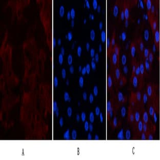 CD23 Monoclonal Antibody avatar