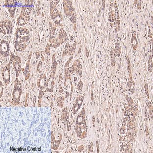 CD5 Monoclonal Antibody avatar