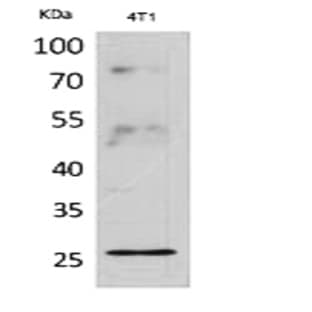 CD81 Polyclonal Antibody avatar
