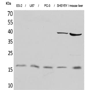IL-1? Polyclonal Antibody avatar