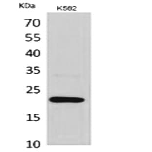 IL-6 Polyclonal Antibody avatar