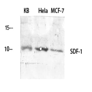 SDF-1 Polyclonal Antibody avatar