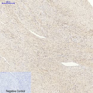 Akt Polyclonal Antibody