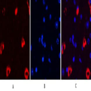 MAP2 Monoclonal Antibody avatar