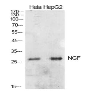 NGF Polyclonal Antibody avatar