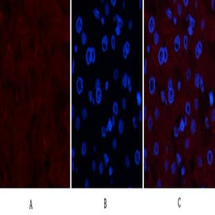 Collagen IV Mouse Monoclonal Antibody(8E5) avatar