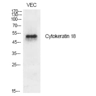 Cytokeratin 18 Polyclonal Antibody avatar