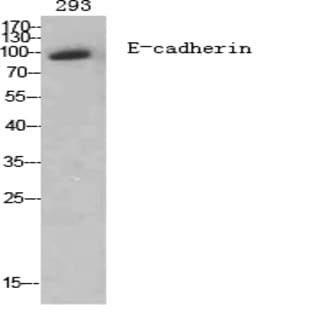 E-cadherin Polyclonal Antibody avatar