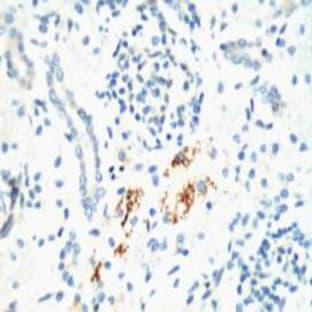 Kif 7 Monoclonal Antibody avatar