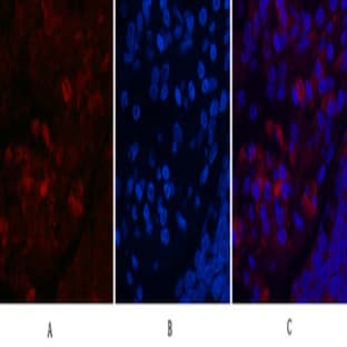LC3A Mouse Monoclonal Antibody(5G10) avatar