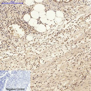 AP-1 Polyclonal Antibody avatar