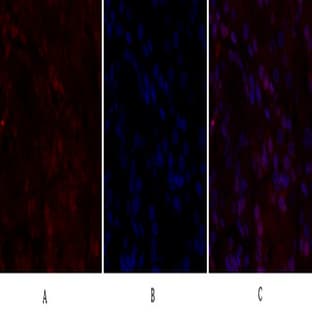 BRCA1 Polyclonal Antibody avatar