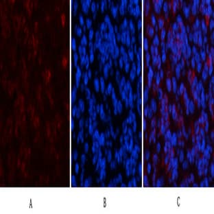HP-1? Mouse Monoclonal Antibody(2F5) avatar