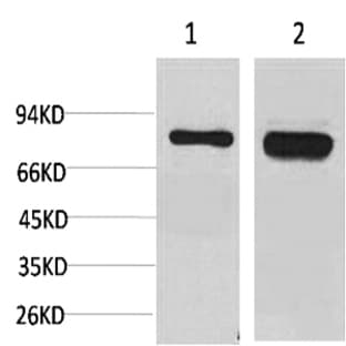 p70 S6 kinase ? Polyclonal Antibody avatar