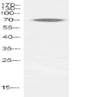 p70 S6 kinase ? Polyclonal Antibody avatar