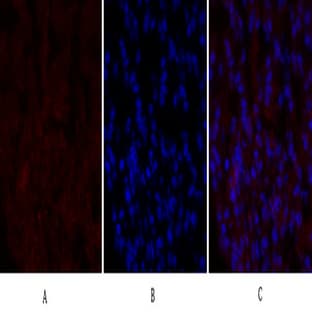 PERK Polyclonal Antibody