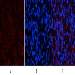 PPAR Delta Mouse Monoclonal Antibody(2F9)