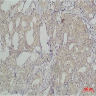 SLUG Polyclonal Antibody avatar