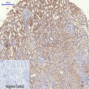 TERT Polyclonal Antibody avatar