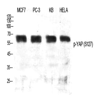 YAP (phospho Ser127) Polyclonal Antibody avatar