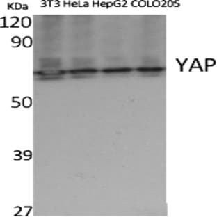 YAP Polyclonal Antibody avatar