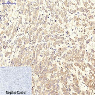 CD41 Monoclonal Antibody avatar