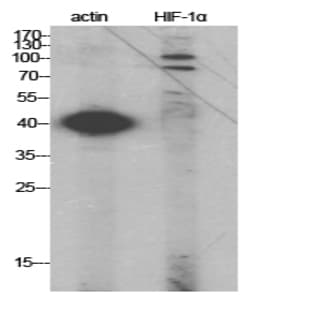 HIF-1? Polyclonal Antibody avatar