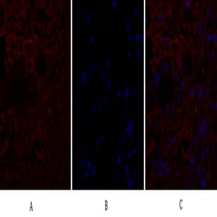 IL-8 Polyclonal Antibody avatar