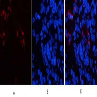 Lactoferrin Monoclonal Antibody avatar