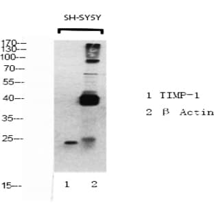 TIMP-1 Polyclonal Antibody avatar