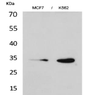 Cdk4 Polyclonal Antibody avatar
