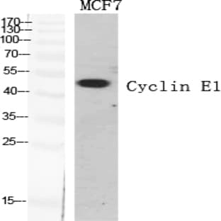 Cyclin E1 Polyclonal Antibody avatar