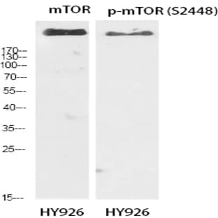 mTOR (phospho Ser2448) Polyclonal Antibody avatar