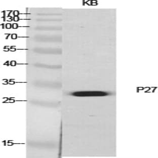 p27 Polyclonal Antibody avatar