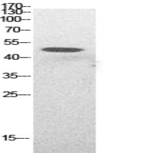 p53 (Acetyl Lys382) Polyclonal Antibody avatar