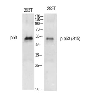 p53 (phospho Ser15) Polyclonal Antibody avatar