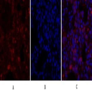 Calnexin Polyclonal Antibody avatar
