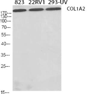 COL1A2 Polyclonal Antibody avatar